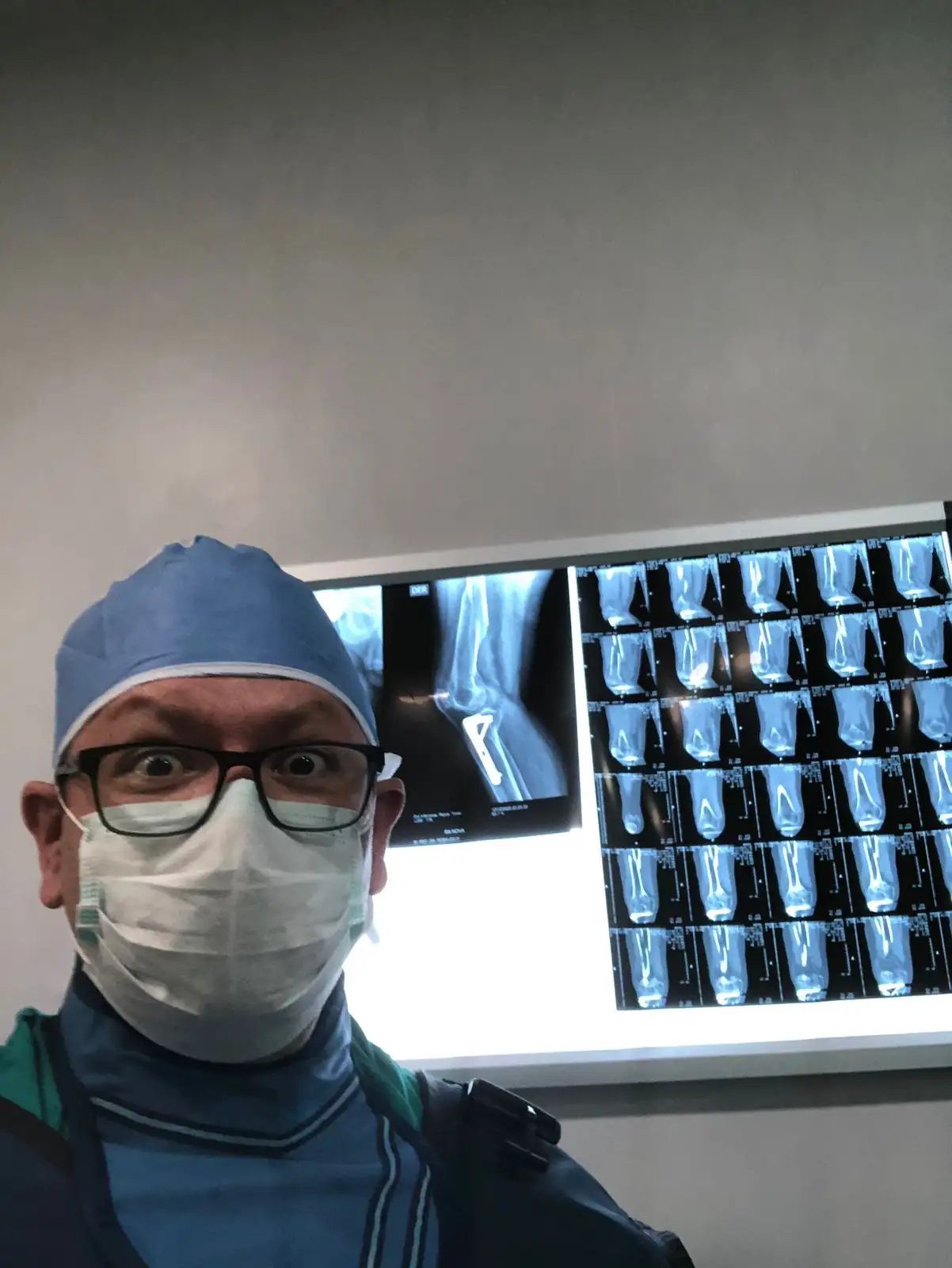 Placeholder trauma de rodilla