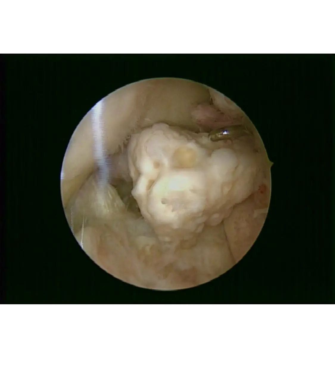 Dr. Luis Calderón con visor quirúrgico